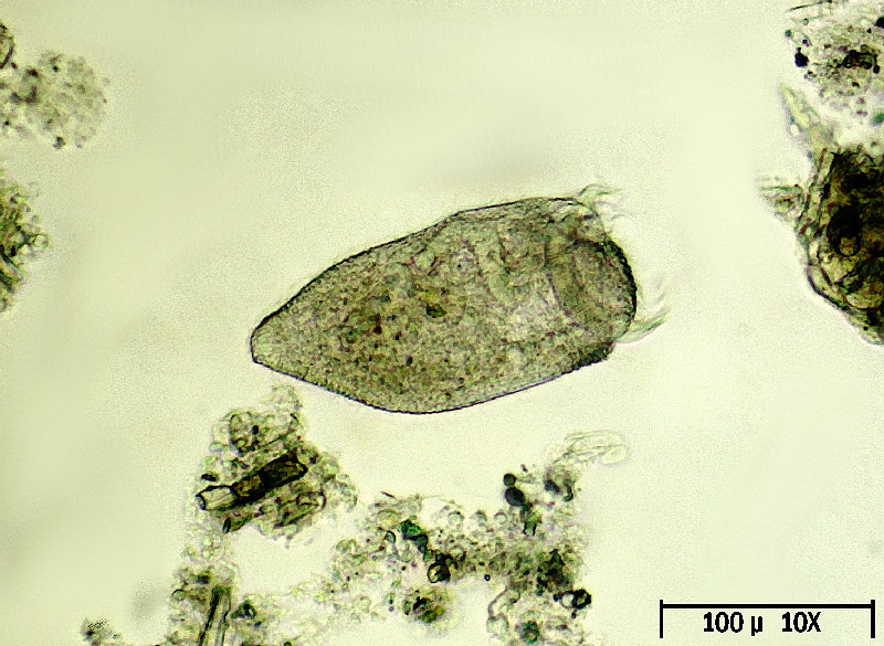 Stentor sp.  - ancorato e vagante