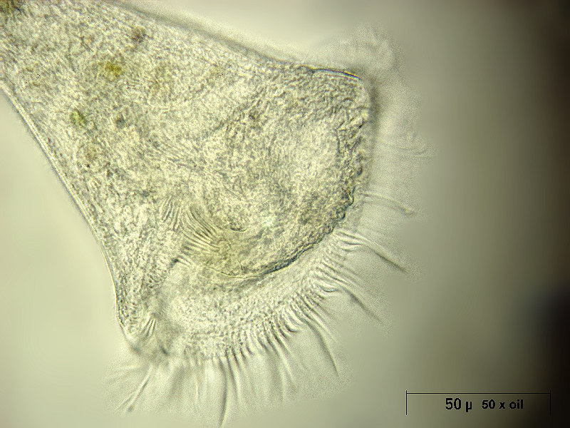 Stentor sp. - zona adorale