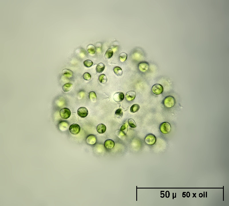 Dictyosphaerium sp.