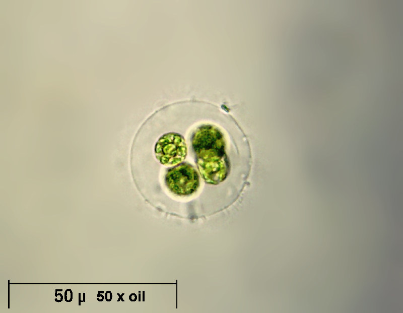 Asterococcus sp.