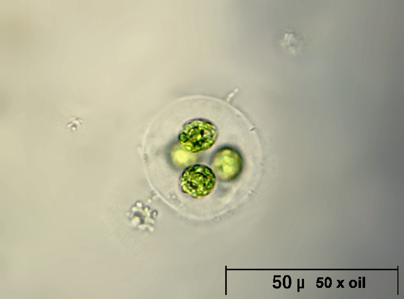 Asterococcus sp.