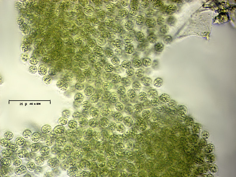 Microcystis aeruginosa