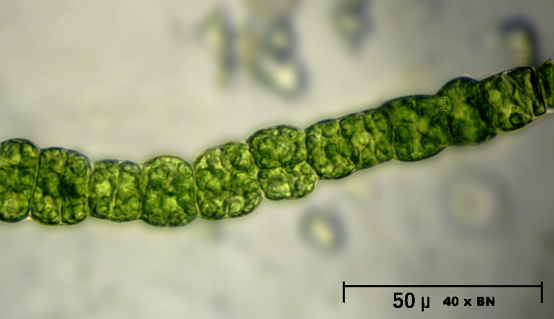 Hyalotheca sp. -- no no