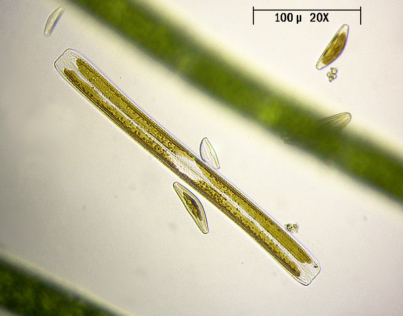 Nitzschia sigmoide