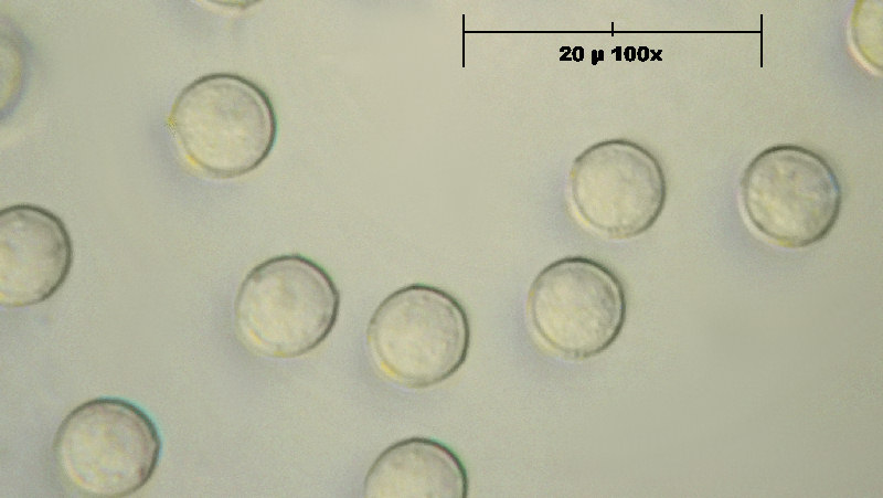 e questi ? - Arcyria stipata ?