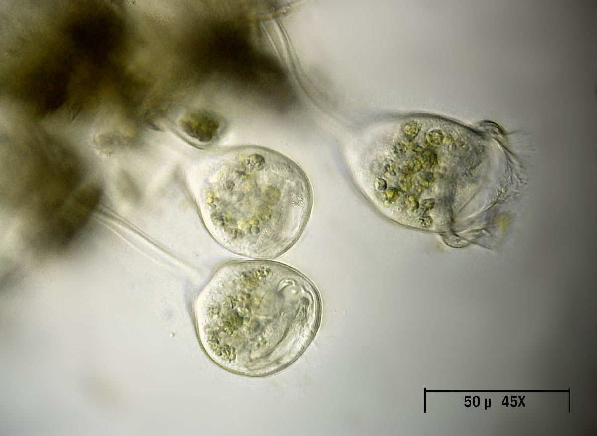 Vorticella sp.