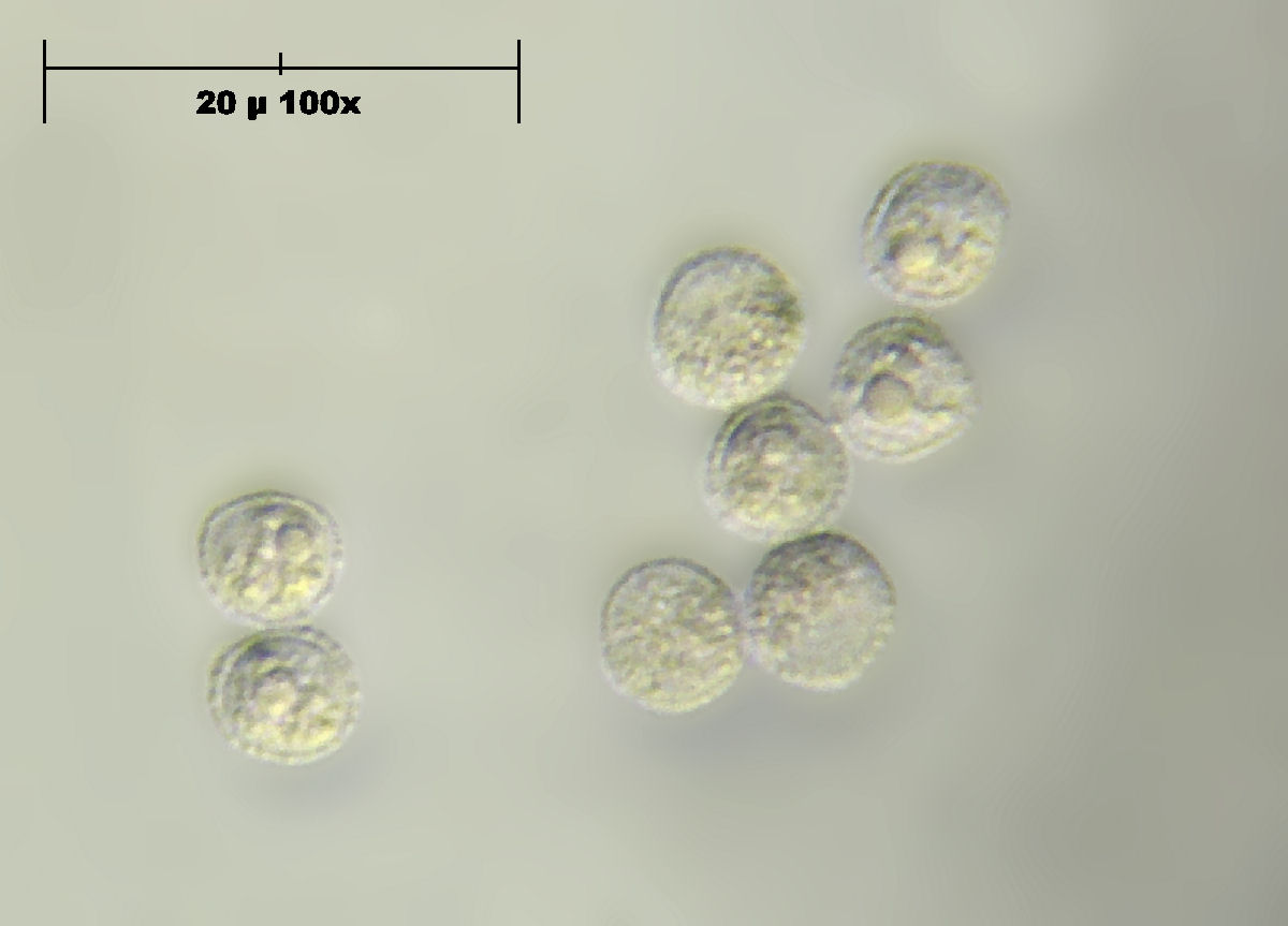 che mixomicete  ?  - Lycogala sp.