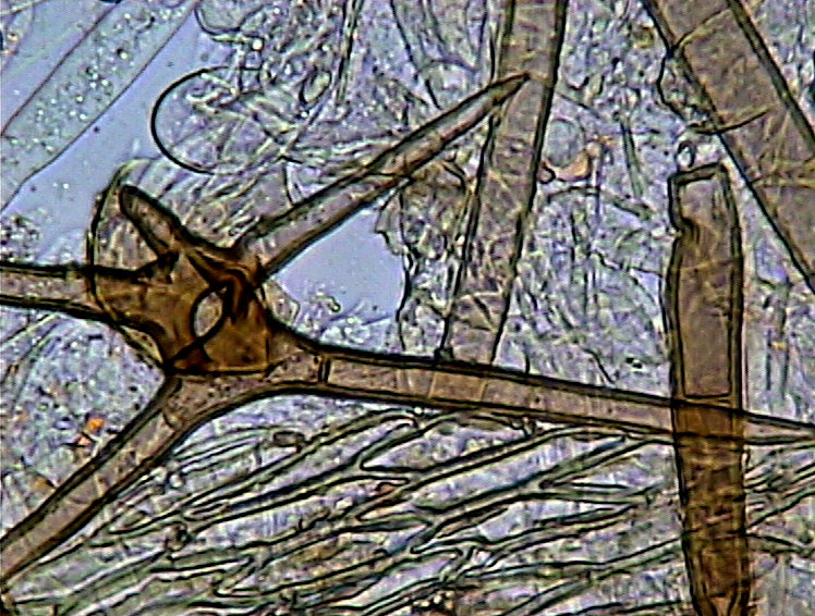 Cheilymenia stercorea (Pers. Fr.) Boud. f. stercorea