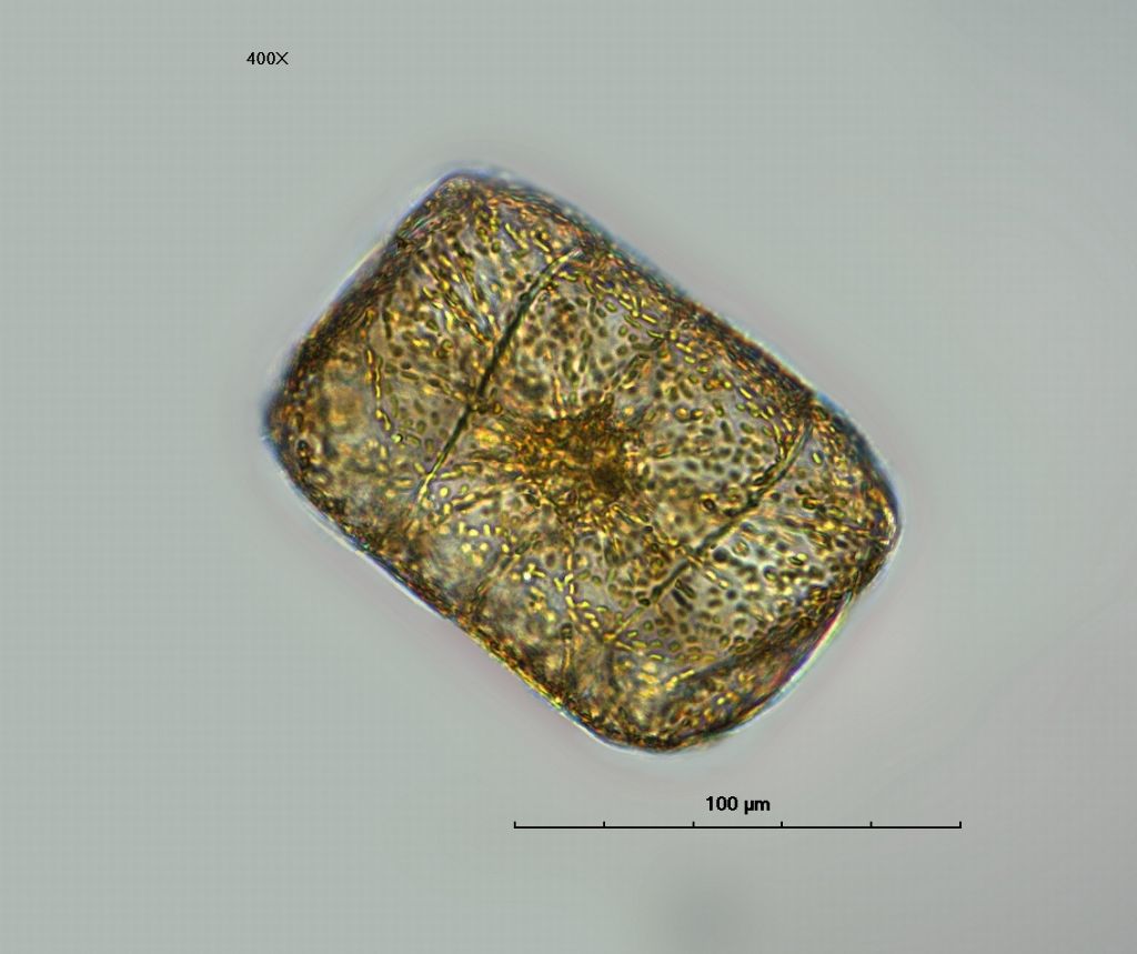 Isthmia nervosa Kuetzig ---diatomea--- (esemplare vivo)