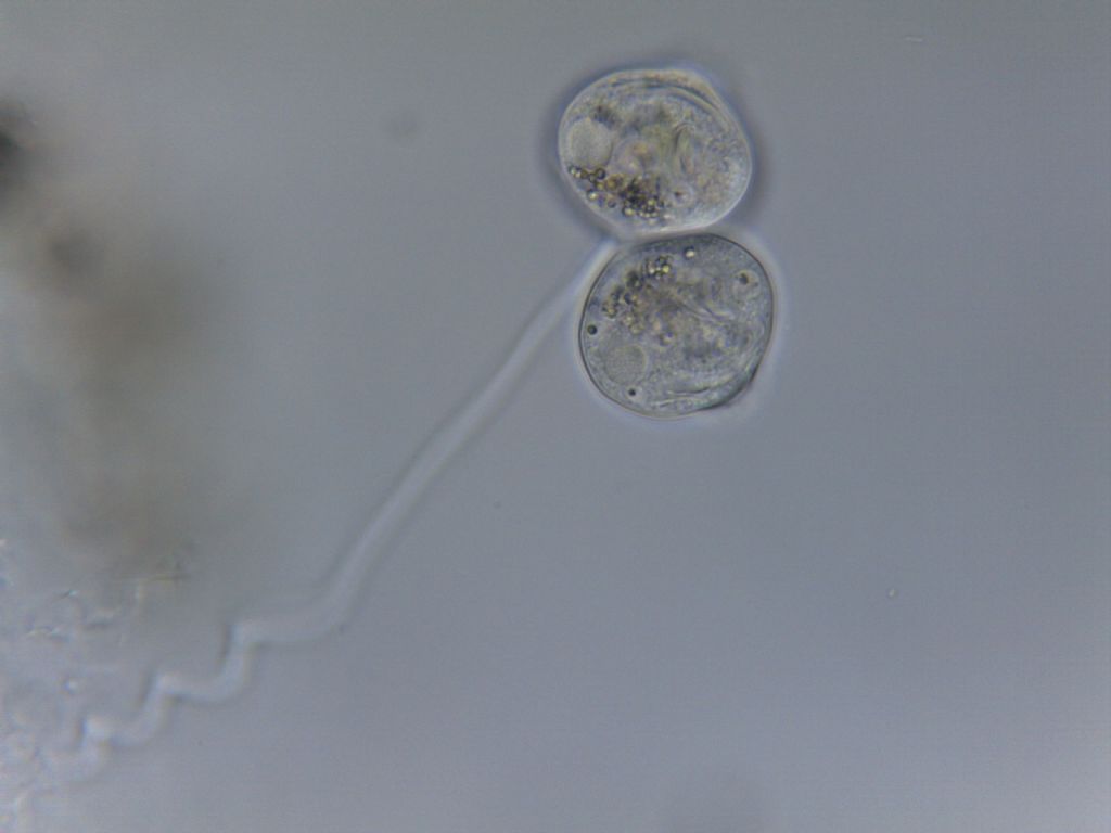 Vorticella sp. (riproduzione asessuata)