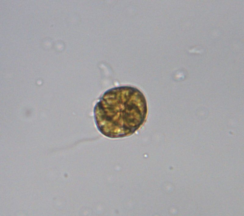 Gymnodinium breve (dinoflagellato)