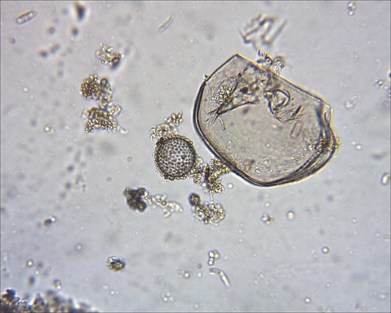 uova di tardigrado