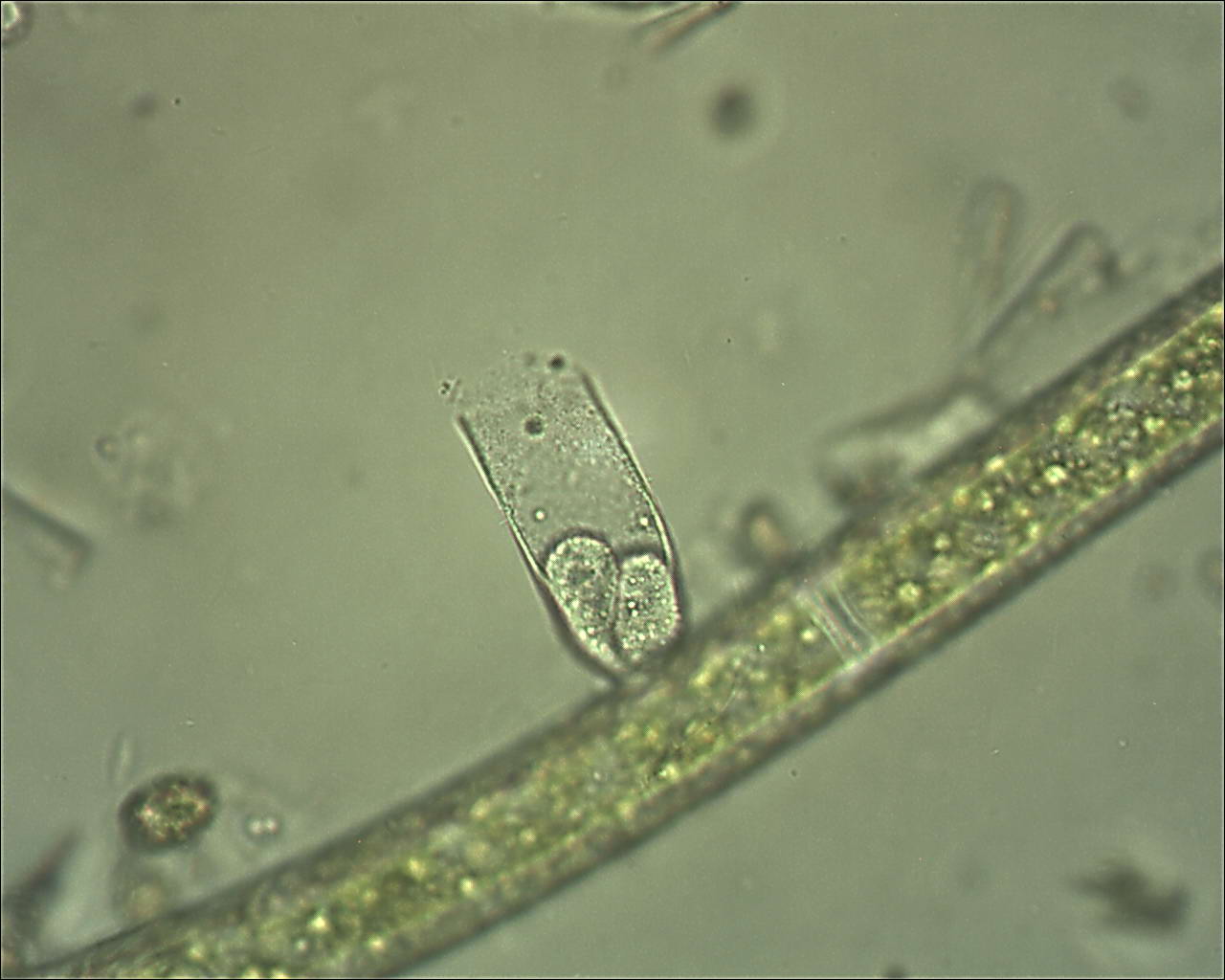 Vaginicola subcrystallina