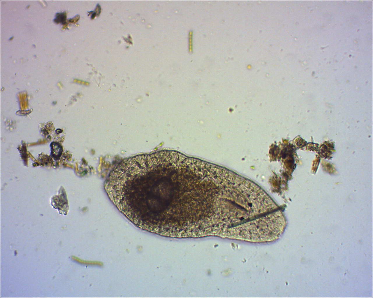 mesostoma sp.