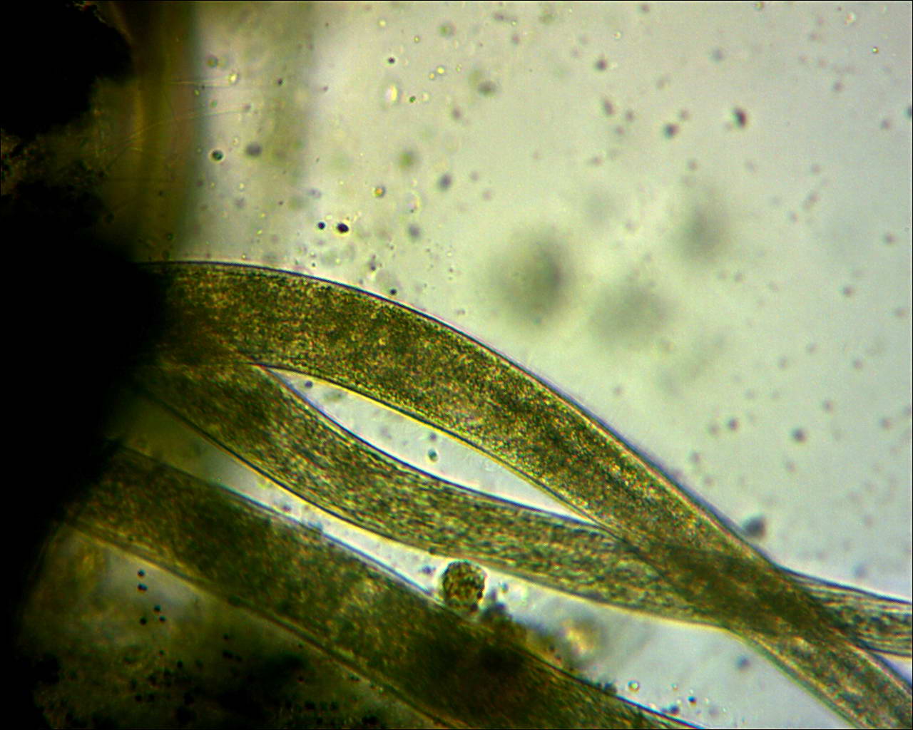 Spirostomum (foto)