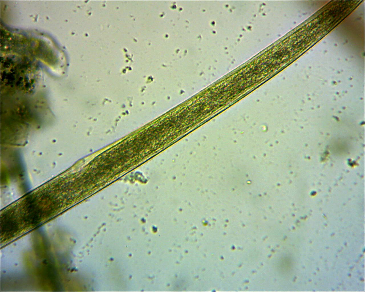 Spirostomum (foto)