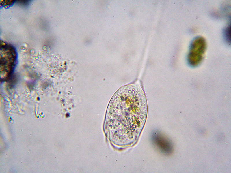 vorticella