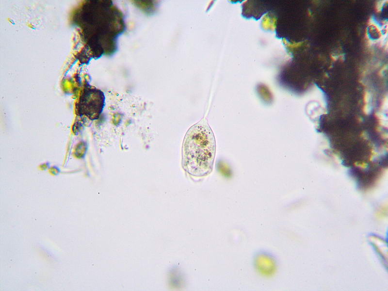 vorticella