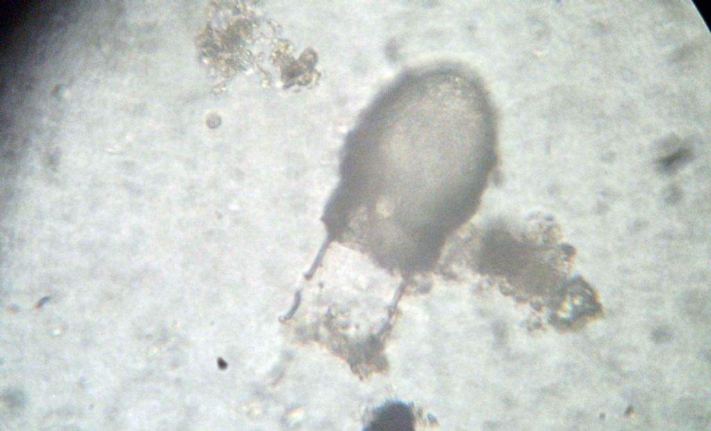 Codonellopsis sp