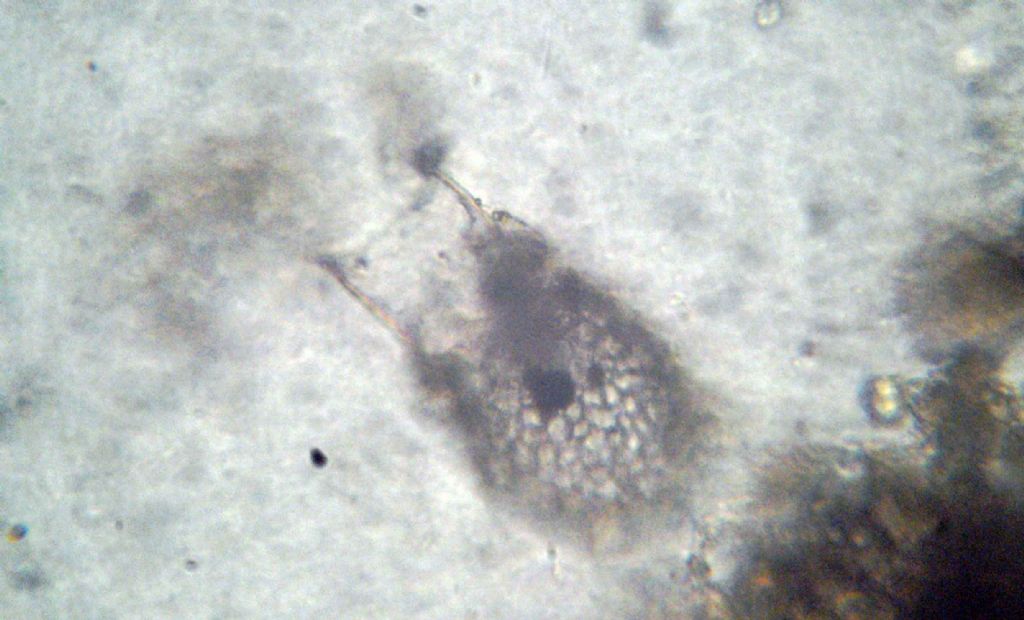 Codonellopsis sp