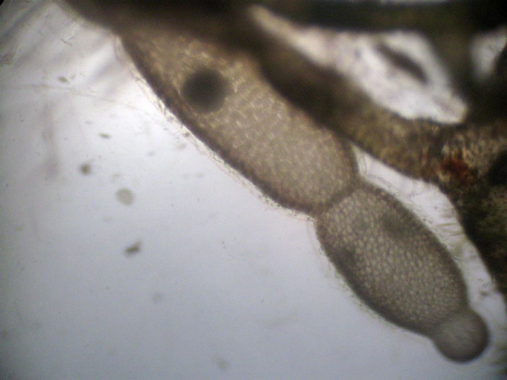 Microscopia: Dictyota sp?