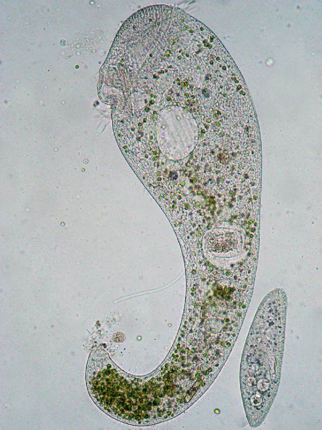 VORTICELLE e STENTOR