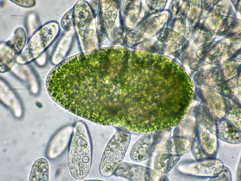 PARAMECIUM-bursaria