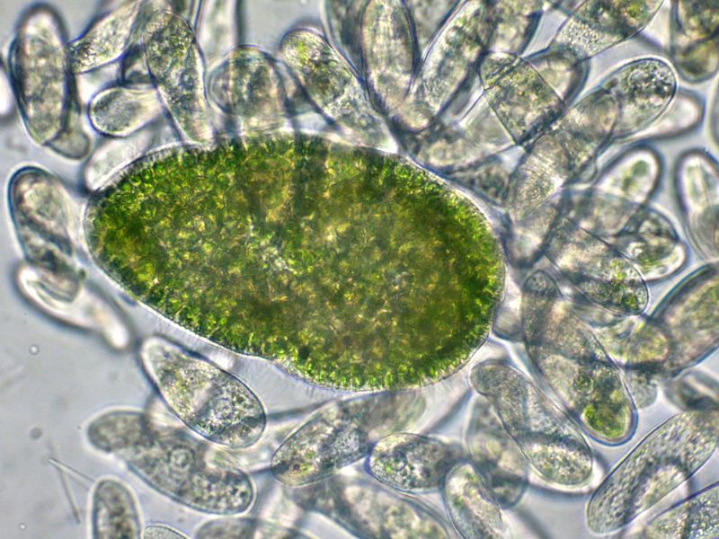 PARAMECIUM-bursaria