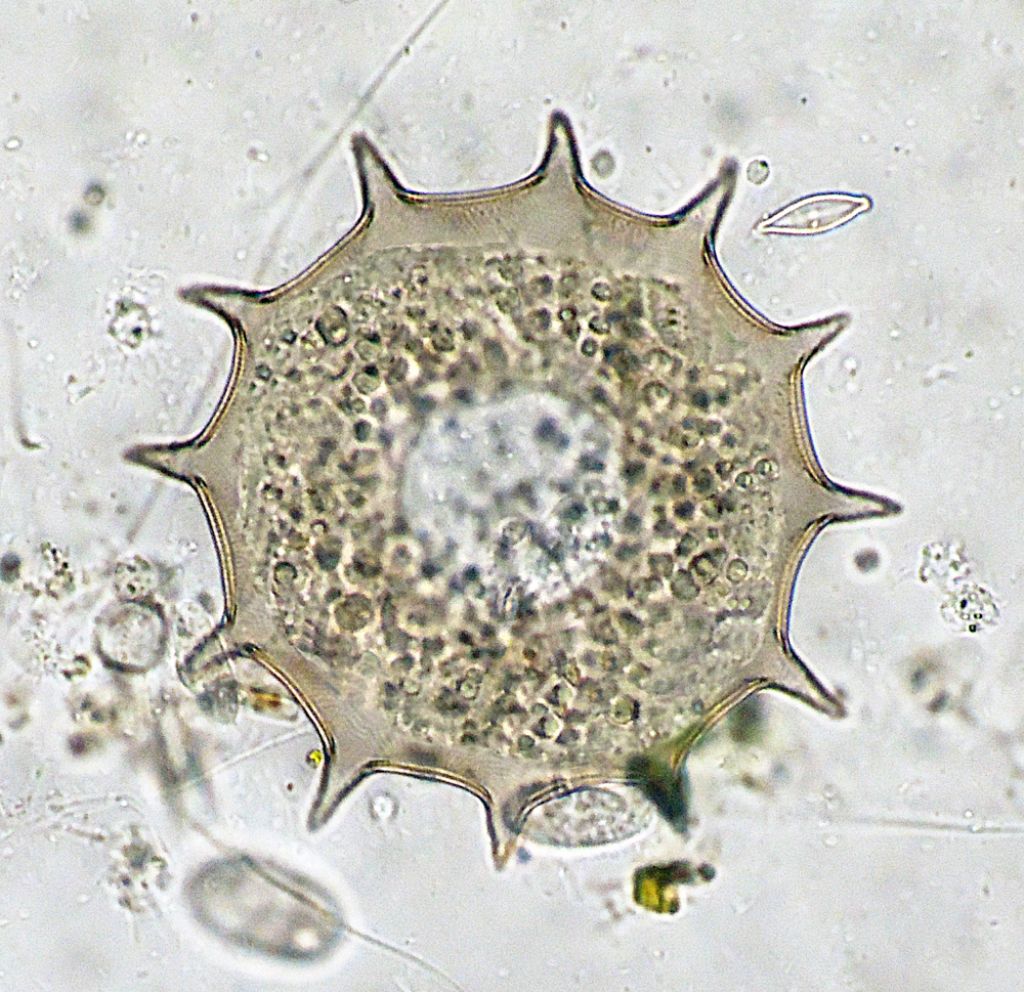 Arcella-dentata e gibbosa