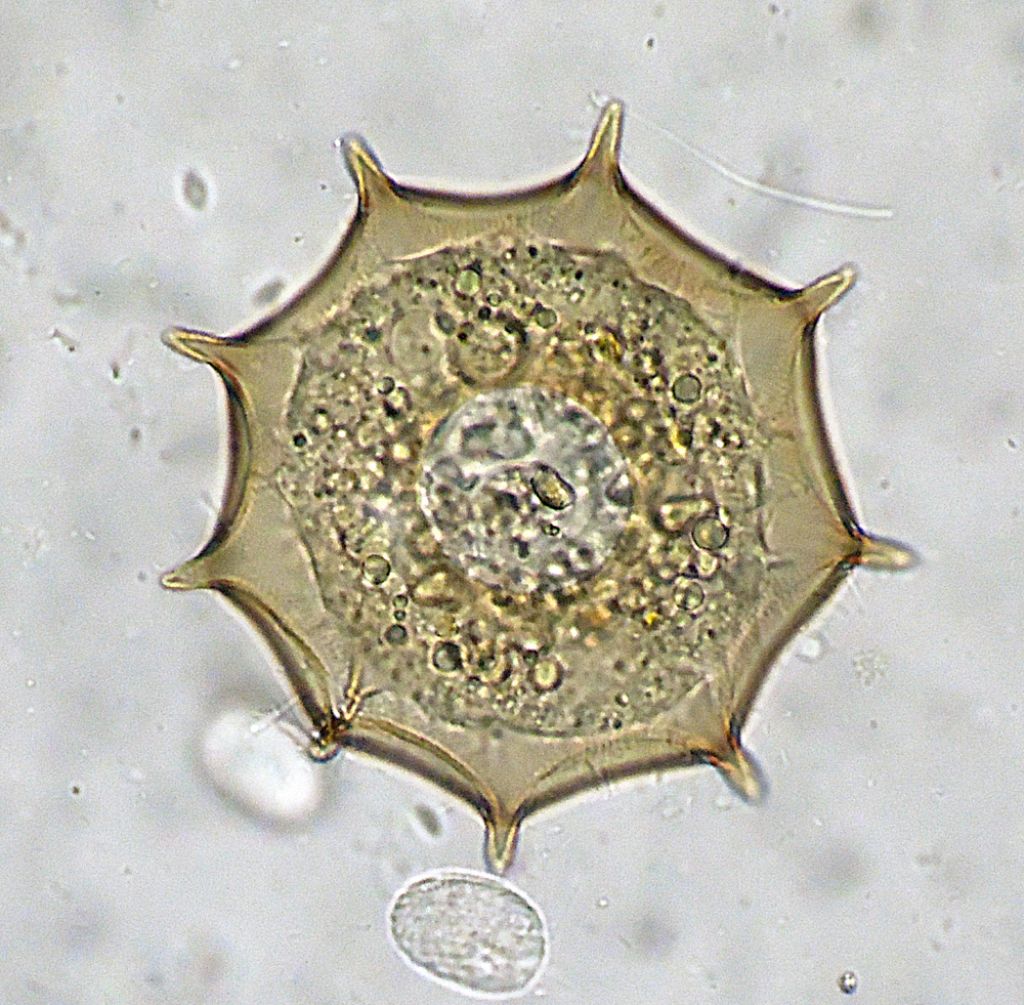 Arcella-dentata e gibbosa