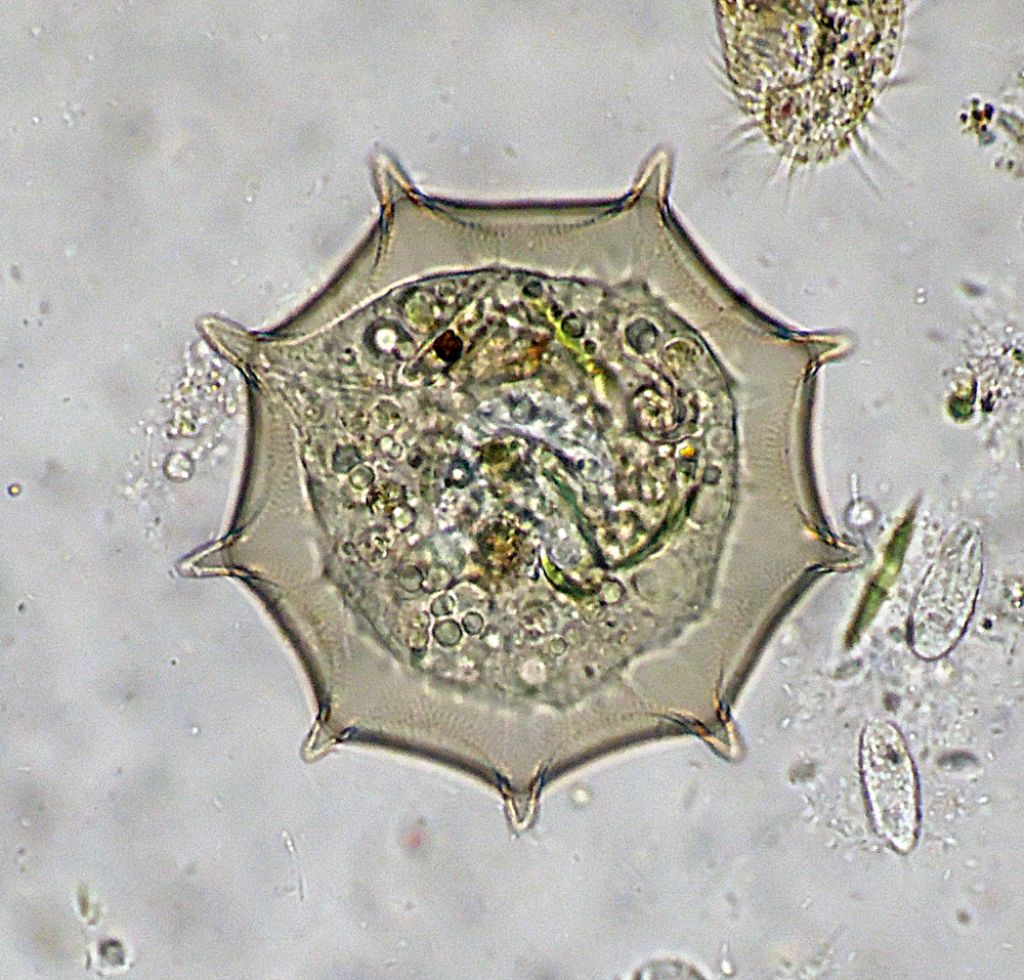 Arcella-dentata e gibbosa