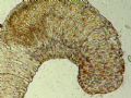 Aeolosoma Hemprichi