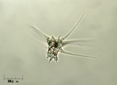 Amoebidae