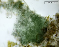 Microcystaceae