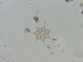 Pediastrum simplex