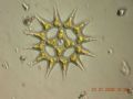 Pediastrum simplex