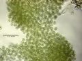 Microcystis aeruginosa