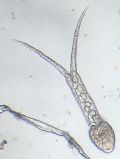 Trichobilharzia sp.