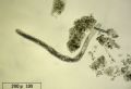 Spirostomum sp.