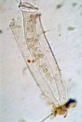 Vaginicola sp.